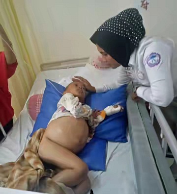 Fazrul Aziq, Bocah Penderita Tumor Butuh Uluran Tangan Dermawan