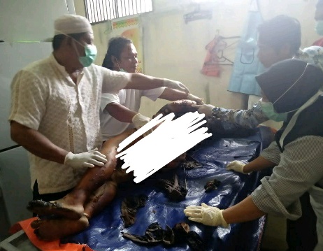 Geger,Wanita Muda Bakar Diri Hingga Tewas