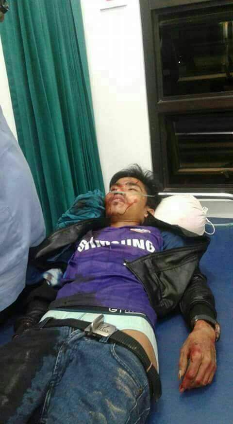 Perampasan Dengan mengunakan Senjata Tajam Tidak Segan - Segan Melukai Korbannya