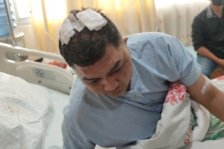 Terkait Penganiaya Wartawan, Polda Riau Belum Tangkap Preman Ngaku Simpatisan Pj Walikota