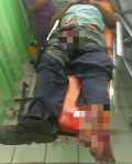 Diduga Karyawan PT IKPP Perawang Terjepit Rol Kaki Patah Dan Selangkangan Robek